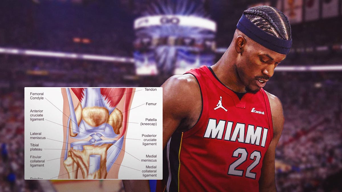Heat's Jimmy Butler looking tired, with diagram of knee injury beside him