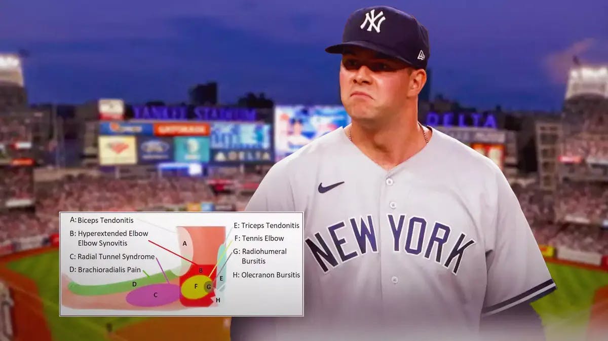 Yankees' Scott Effross with diagrams of back and elbow injuries beside him