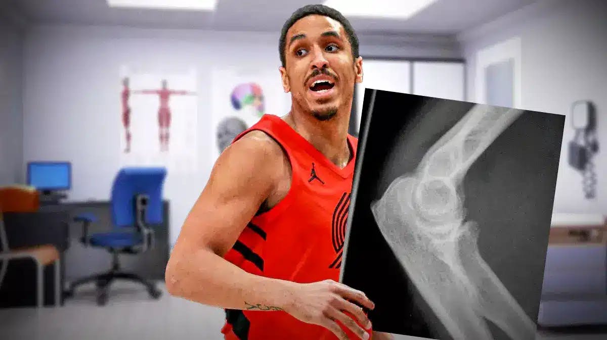: Blazers' Malcolm Brogdon holding a diagram of an elbow injury