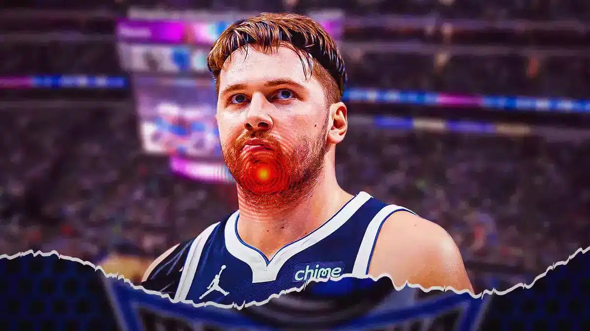 Mavs Luka Doncic with an orb on his chin