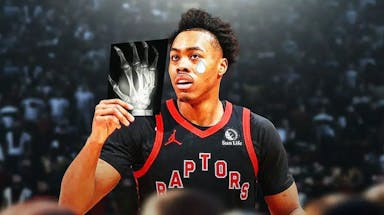 Scottie Barnes with animated tears holding an X-ray showing a fractured hand