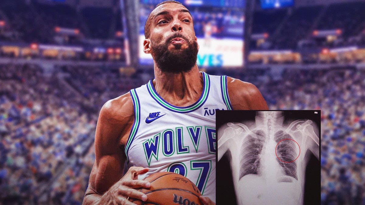 Rudy Gobert wincing in pain with x-ray shot of his rib area